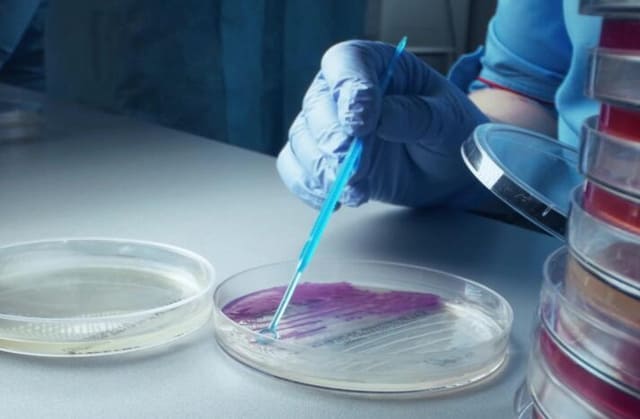 微生物检测中常见问题及解决方案